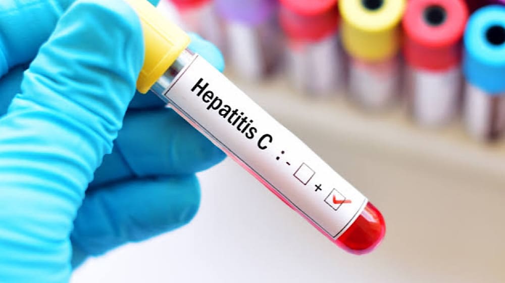 Pakistan Leads in Hepatitis C Cases, WHO Report Reveals